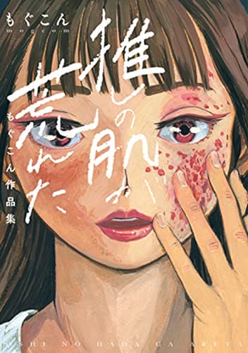 推しの肌が荒れた : もぐこん作品集